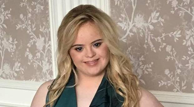 Down sendromlu model  güzellik yarışmasını kazandı - Resim: 2