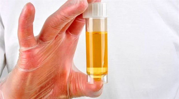 Doktorlardan uyarı: İdrarınızı içmeyin! - Resim: 2