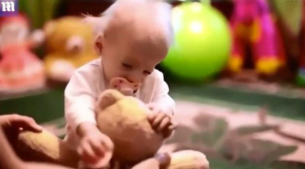 8 yaşında yaşlılık nedeniyle öldü nedeni duyanların ağzını açık bıraktı - Resim: 4