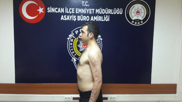 Ankara'da Deccal cinayeti abisinin ruhunu rahatsız ediyor diye öldürdü - Resim: 0