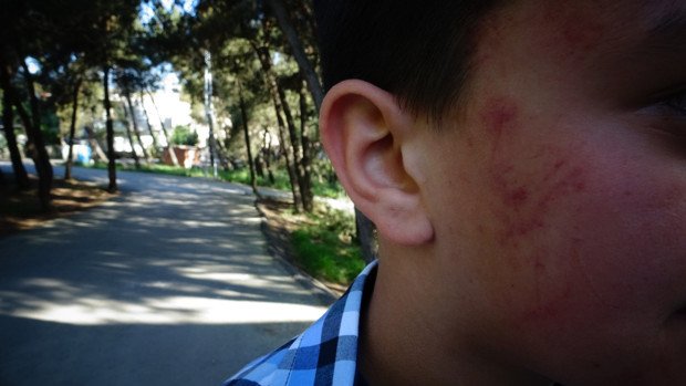 Magandanın öldüresiye dövdüğü çocuk o anları anlattı - Resim: 0