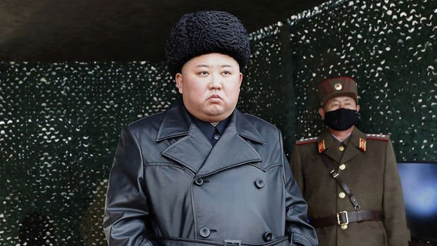 Kuzey Kore lideri Kim Jong-un durumu kritik - Resim: 0