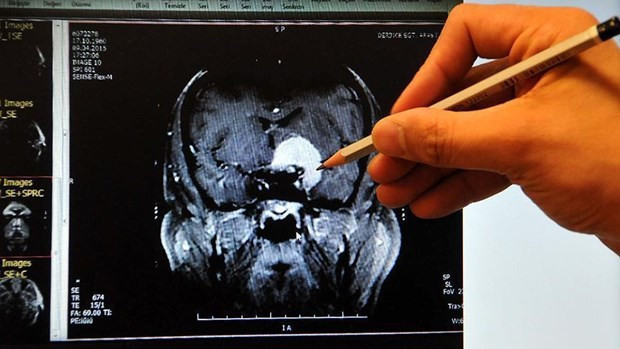 Kadınların beyni çok daha aktif - Resim: 3