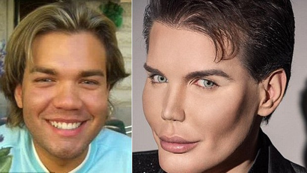 İdeal erkek olabilmek için 1 milyon TL harcadı işte sonuç.. - Resim: 1