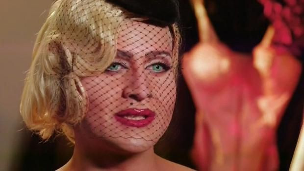 Madonna'ya benzemek istedi defalarca ameliyat oldu - Resim: 1