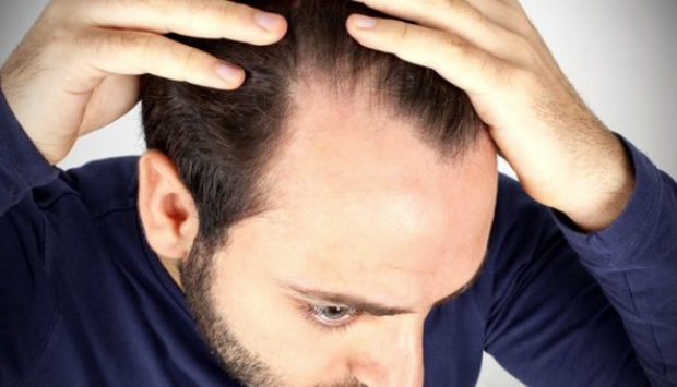 Sürekli kullanılan ilaçların tehlikeli sonucu: Saç dökülmesi - Resim: 0