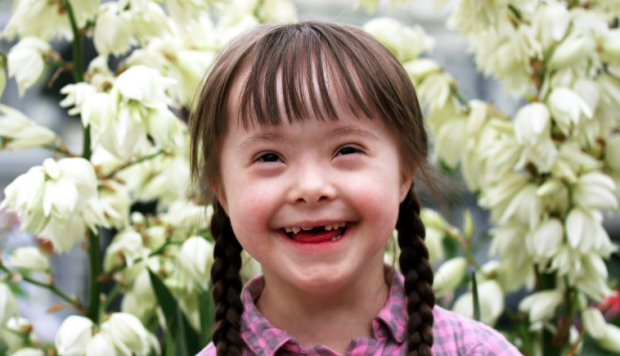 Down sendromlu kişiler kaç kromozomludur? - Resim: 0