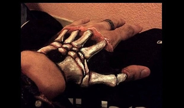 Elini bu hale getirdi çok şaşıracaksınız!  - Resim: 4