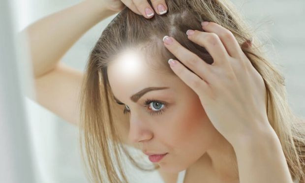 Saç dökülmesi neden olur bazı ilaçlar kel bırakıyor saç kıran da kötü - Resim: 2