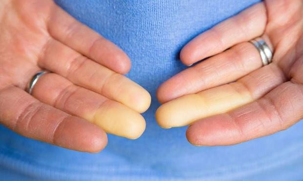 Ünlü sunucu elinin fotoğrafını paylaştı görenler şaştı - Resim: 3