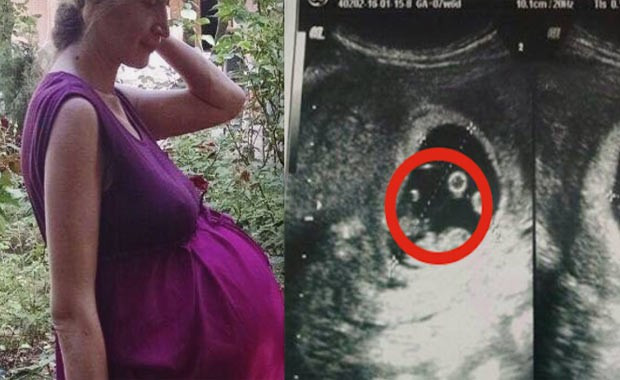 Ukraynalı anne tarih yazdı - Resim: 3