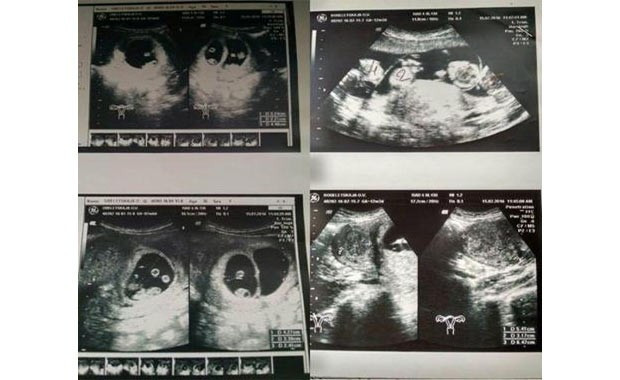 Ukraynalı anne tarih yazdı - Resim: 4