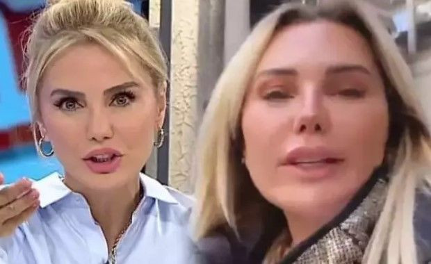 Ece Erken'in son haline bakın!  Bambaşka biri oldu.. - Resim: 3