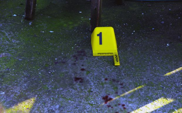 Güvercin uçurma sırası tartışmasında başından vuruldu! - Resim: 0