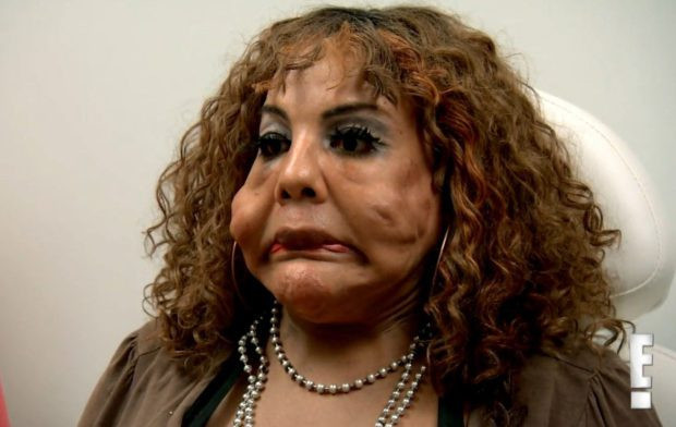 Estetik yaptırayım dedi bu hale geldi sonu ise daha beter - Resim: 4