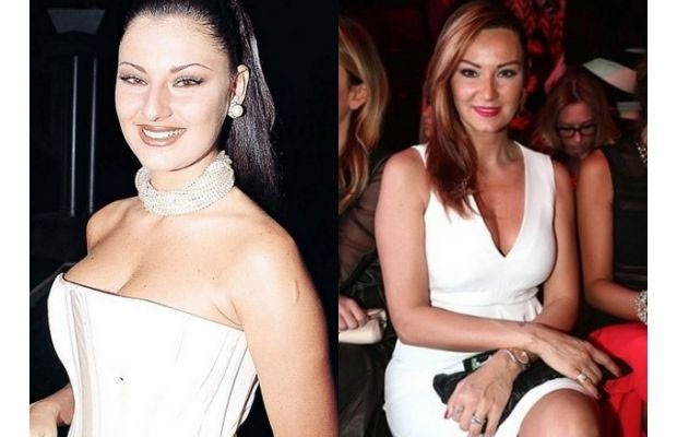 Onlar Yeşilçam'ın efsaneleri estetiksiz hallerine bakın! - Resim: 2