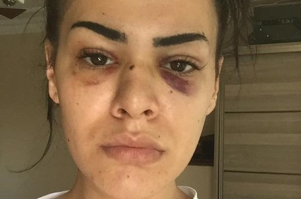 Nagehan Bıyıklı'ya önce taciz sonra darp: Korkudan eve gidemiyorum - Resim: 0