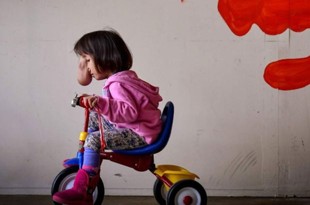 Yüzünü gören dehşete düştü sokağa bile çıkmıyor! - Resim: 1