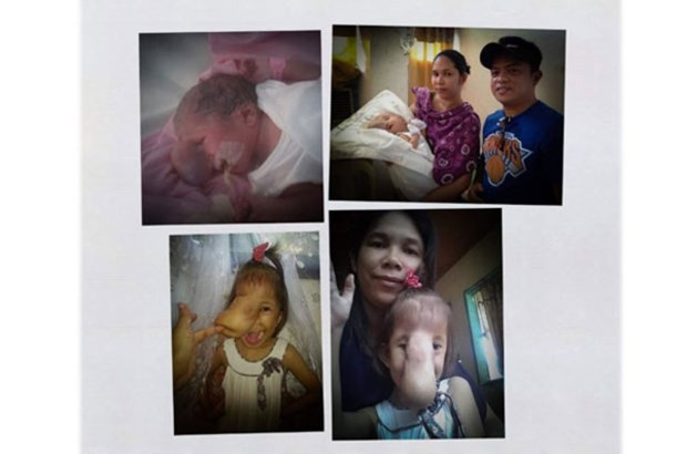 Yüzünü gören dehşete düştü sokağa bile çıkmıyor! - Resim: 2