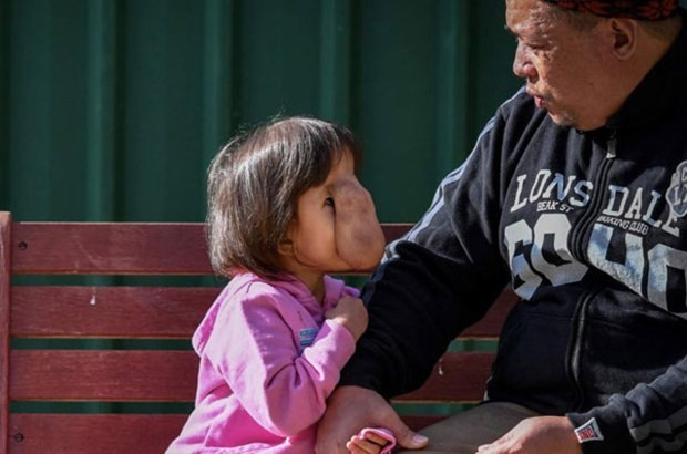 Yüzünü gören dehşete düştü sokağa bile çıkmıyor! - Resim: 3