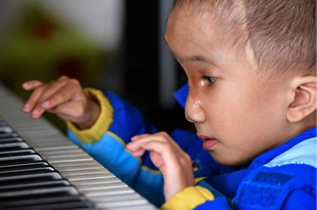 Yüzünü gören dehşete düştü sokağa bile çıkmıyor! - Resim: 4