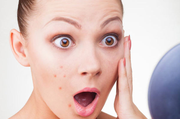 Sivilceden kurtulamıyorsanız bunları sakın yemeyin! - Resim: 2