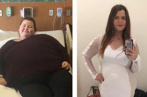 Annesinin bir sözlü ile 100 kilo verdi! - Resim: 2