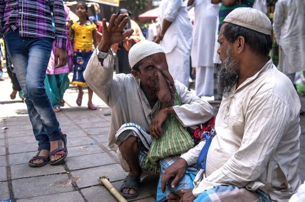 Fil adam ameliyatı reddetti - Resim: 1