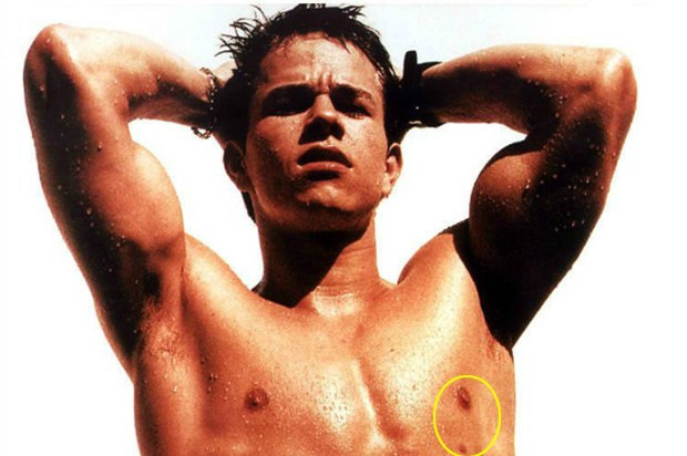 Ünlülerin tuhaf hastalıkları  - Resim: 4