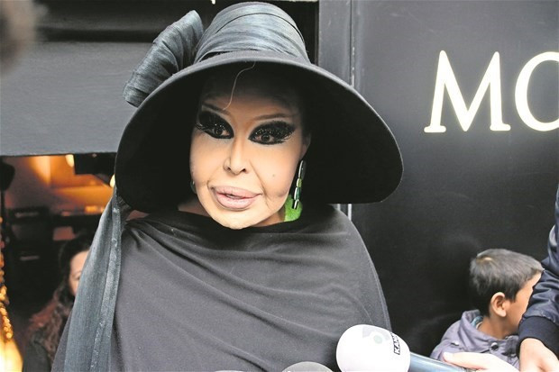 'Kulak nasıl çekilir'i göstermeye hazırlanıyor! - Resim: 4