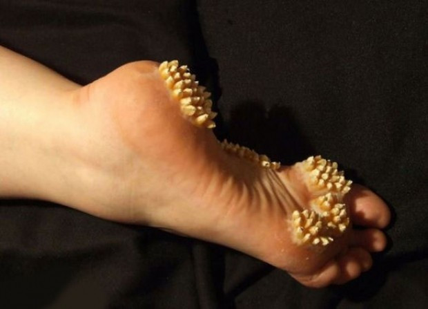 Montaj değil gerçek! Her organı bu hale geliyor korkunç - Resim: 3