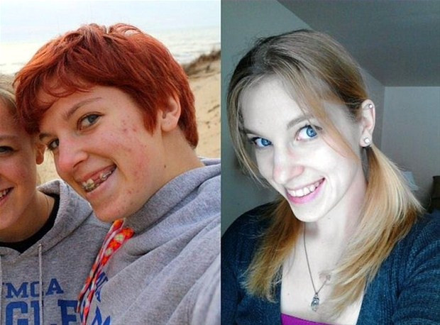 İnanılmaz değişimler! Neydiler ne oldular - Resim: 4