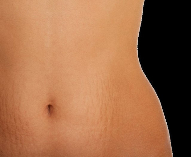 Kadınlar internette en çok bunları arıyor - Resim: 3