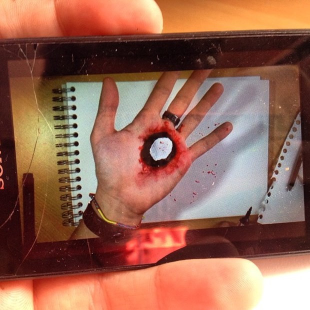 Elini bu hale getirdi çok şaşıracaksınız!  - Resim: 2