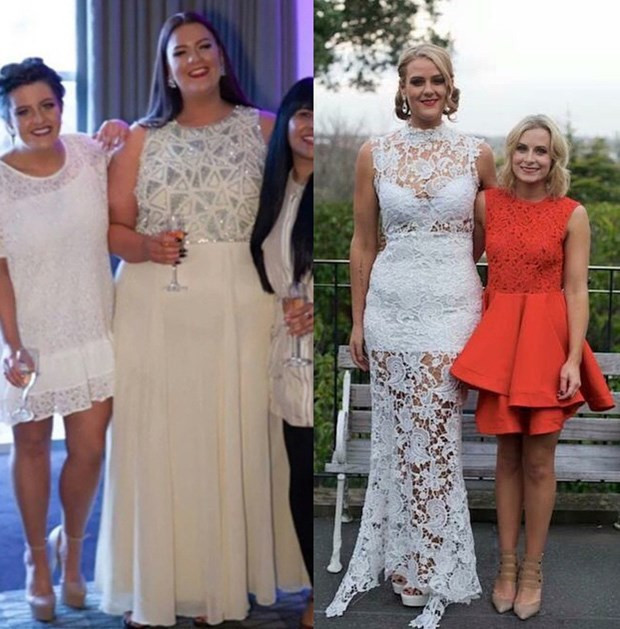 11 ayda tam 86 kilo verdi - Resim: 4