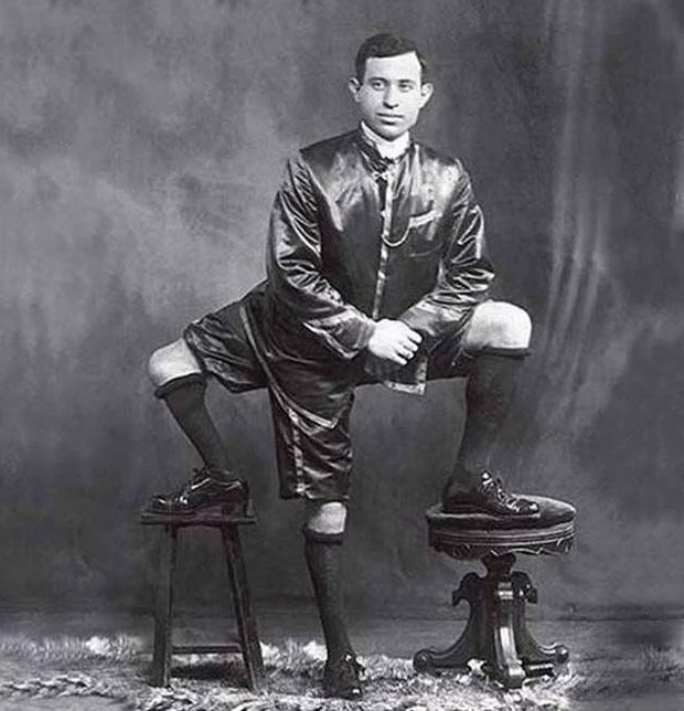 Bu hastalıkların gerçek olduğuna inanmak zor! - Resim: 2