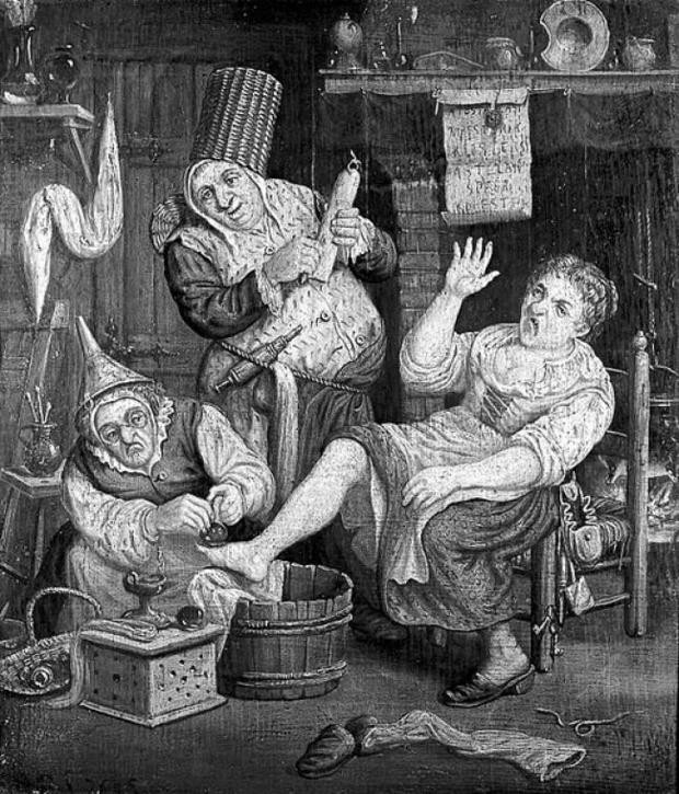 Yok artık diyeceğiniz eski tedavi yöntemleri - Resim: 2