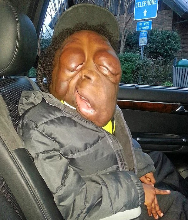 Sadece 8 yaşında ama... Yıllardır tümörle mücadele ediyor - Resim: 2