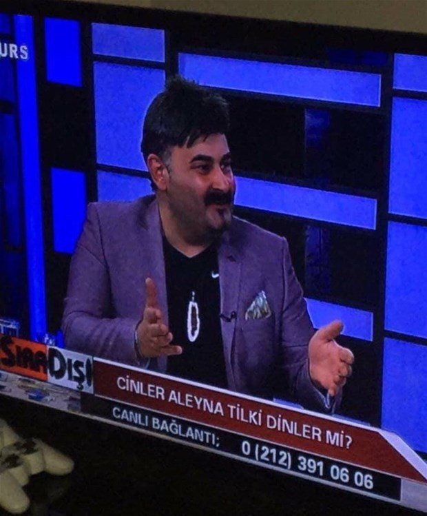 Kolunu görünce bir anda bastı kahkahayı - Resim: 2