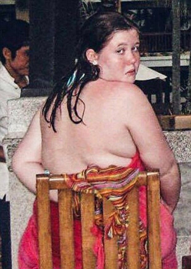 Eskiden obezdi şimdi en popüler mankenlerden biri - Resim: 2