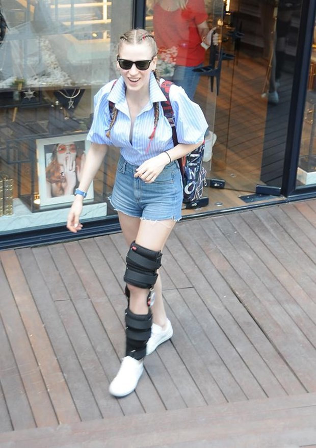 Serenay Sarıkaya'nın bacağındaki morluklara bakın!  - Resim: 1