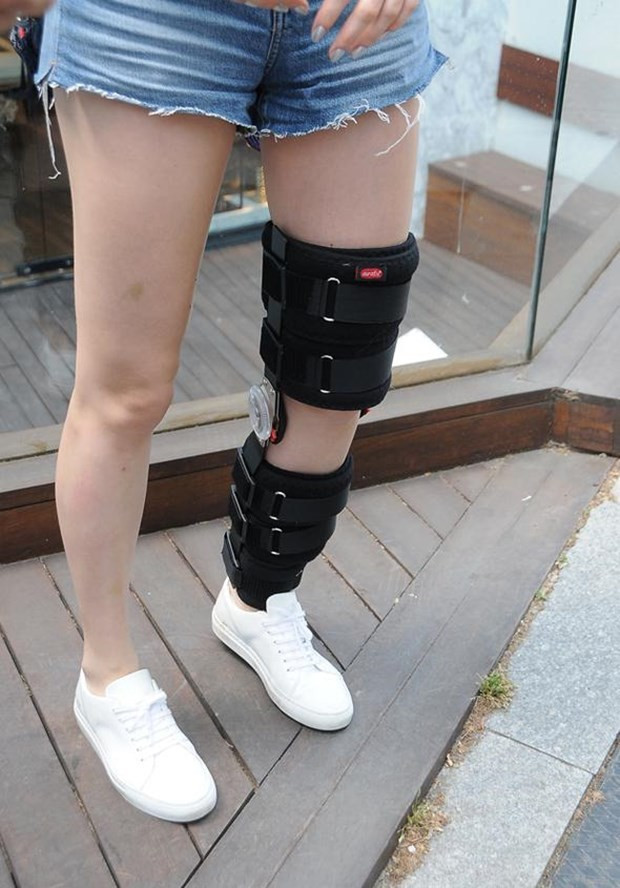 Serenay Sarıkaya'nın bacağındaki morluklara bakın!  - Resim: 3