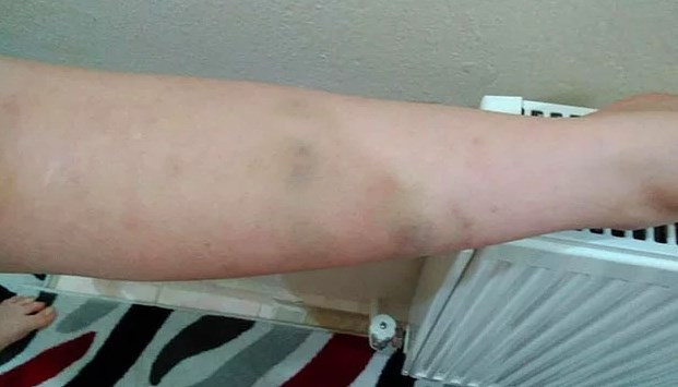 Dayağın fotoğrafını paylaştı cesedi bulundu! - Resim: 3