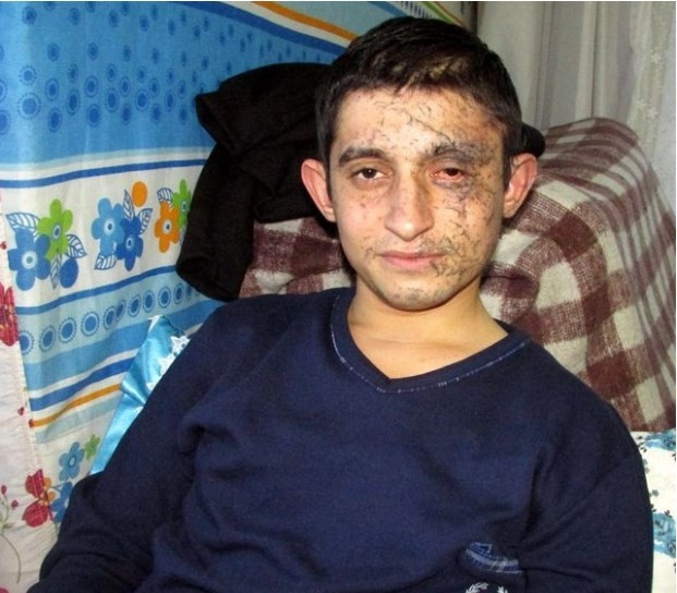 Kayseri saldırısından kurtulan asker yaşadıklarını anlattı - Resim: 1