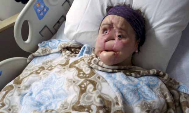 Aldatıldı intihar etmeye çalıştı! Genç kızın ilham verici öyküsü... - Resim: 3