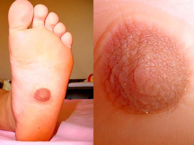 Bu hastalıkların gerçek olduğuna inanmak zor! - Resim: 1