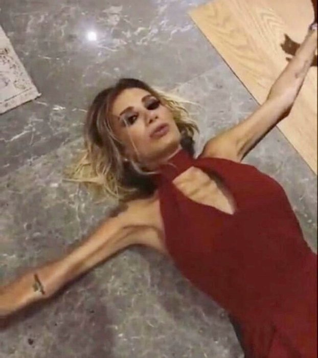 İrem Derici'nin son haline bakın kilo aldı hemen sahneye çıktı! - Resim: 1