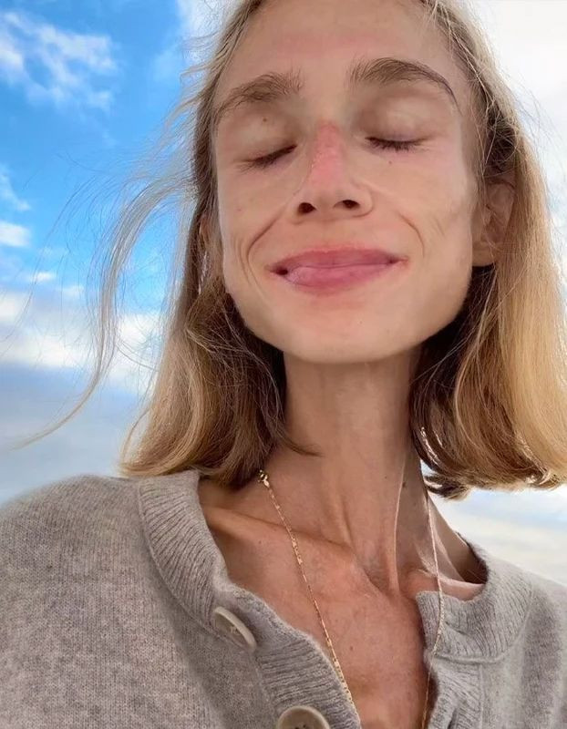 22 kiloya kadar düşmüştü! Sosyal medya fenomeni kaldığı otelde hayatını kaybetti - Resim: 1