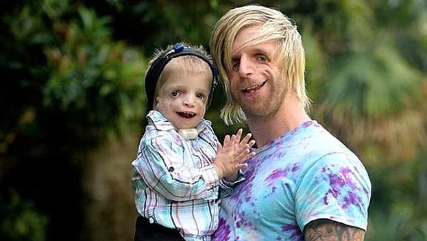 Ailesi onu gördüğü anda terk etti bir milyoner evlatlık aldı ve... - Resim: 4