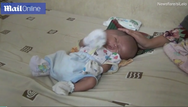 Dünya onları konuşuyor! İki yüzle doğdular  - Resim: 1